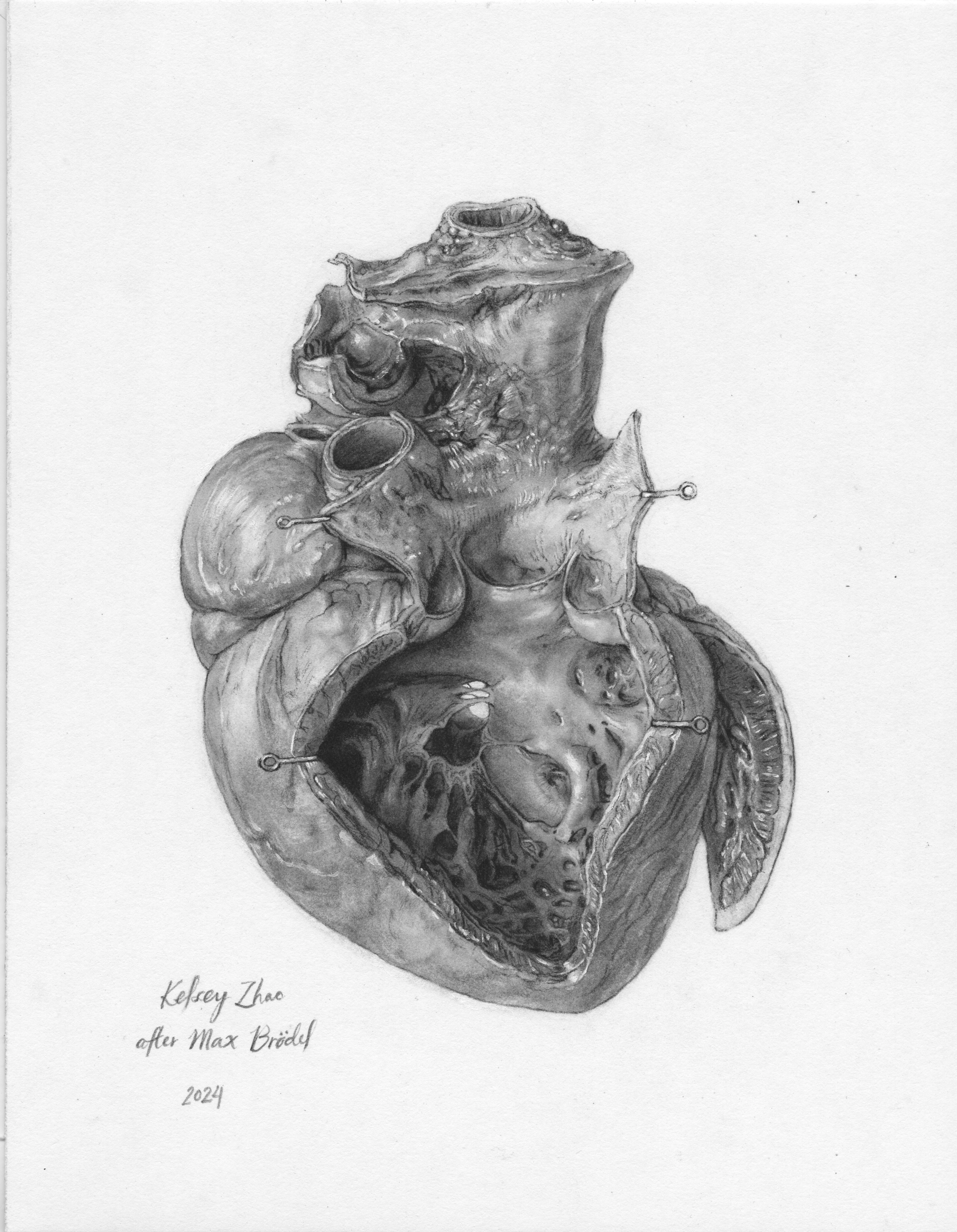 Master study of Max Brodel's Heart