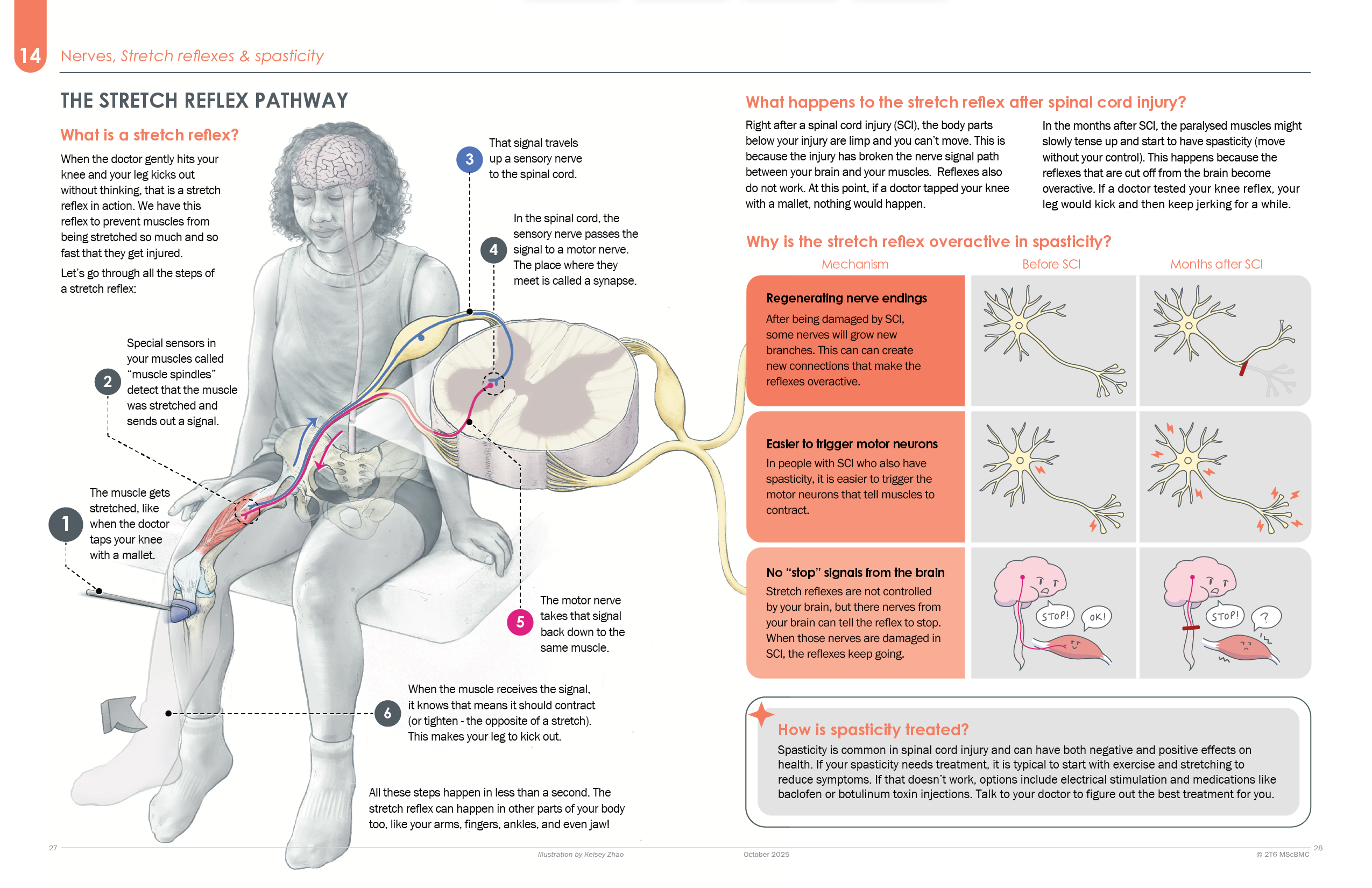 Stretch Reflex Pathway