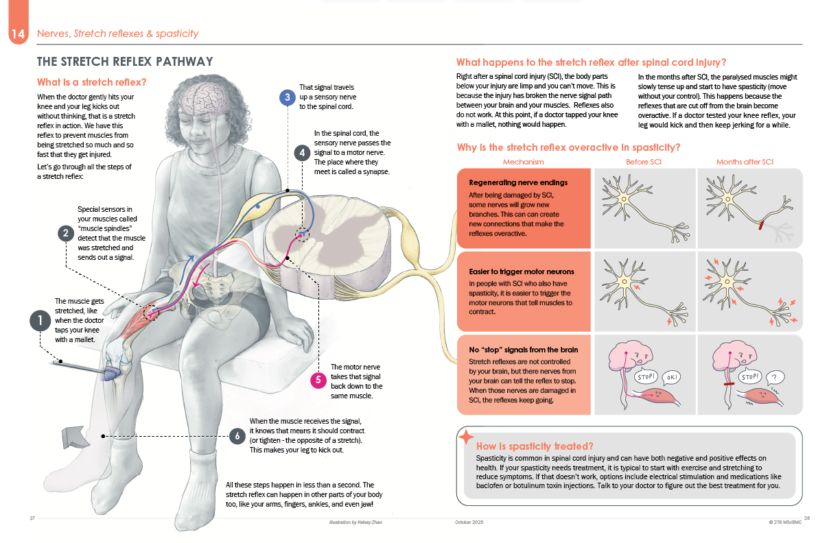 Stretch Reflex Pathway